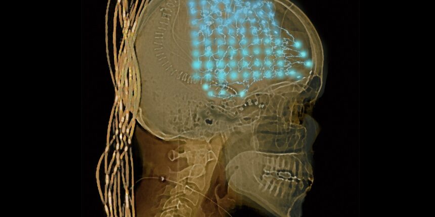 Neuroscientists listened in on people’s brains for a week. They found order and chaos.