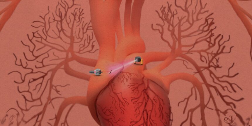 Medical microrobots that can travel inside your body are (still) on their way