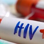 HIV किन-किन वजहों से होता है? जानें