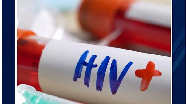 HIV किन-किन वजहों से होता है? जानें